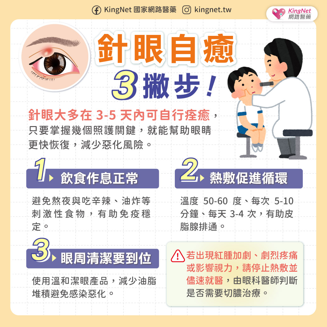 針眼藥膏怎麼塗才好?詳細藥膏類型與用法介紹,讓你正確使用不NG!_圖3 針眼藥膏怎麼塗才好?詳細藥膏類型與用法介紹,讓你正確使用不NG!_圖3