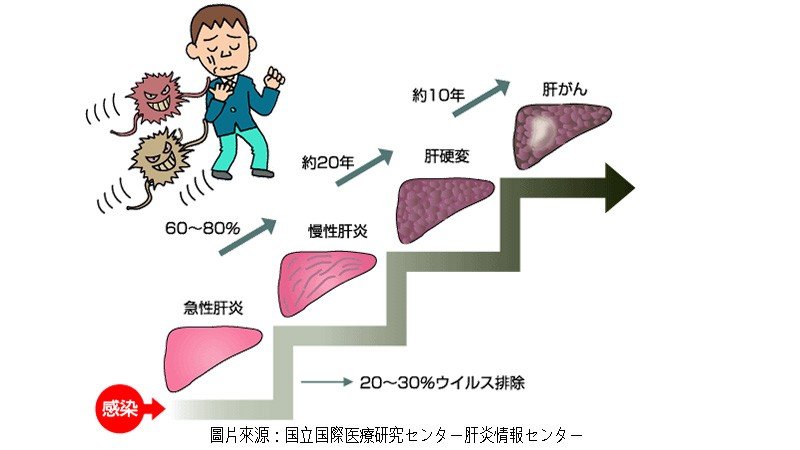 C型肝炎知多少？