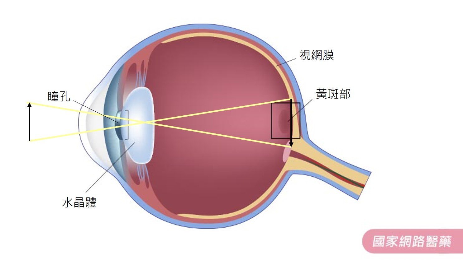 視遠或視近出現霧黑？黃斑部病變簡介