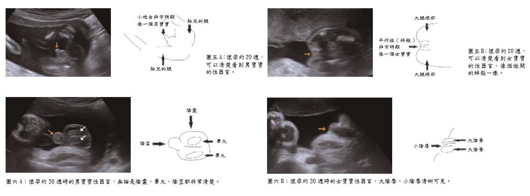 超音波看胎兒性別的真相_圖3 超音波看胎兒性別的真相_圖3