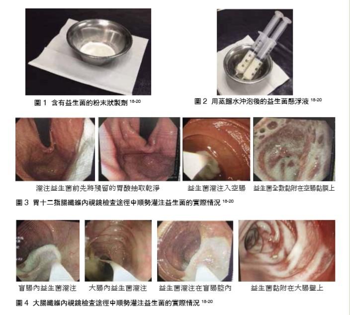 益生菌的迷思∼兼論益生菌給與途徑的探討與分享