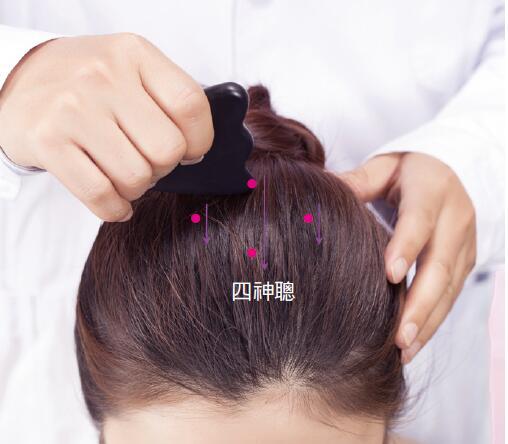 掌握刮痧手法 失眠、落枕不藥而癒!_圖6 掌握刮痧手法 失眠、落枕不藥而癒!_圖6