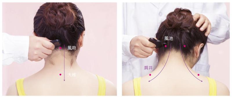 掌握刮痧手法 失眠、落枕不藥而癒!_圖10 掌握刮痧手法 失眠、落枕不藥而癒!_圖10