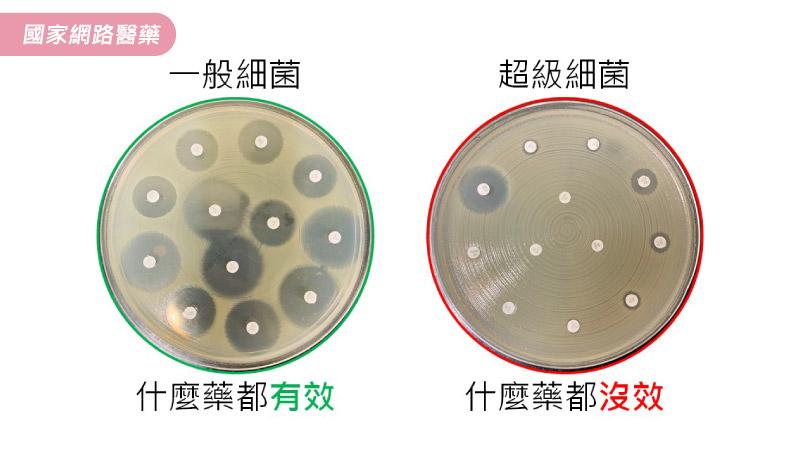 獵殺超級細菌計畫！長庚開發預測模型抓菌