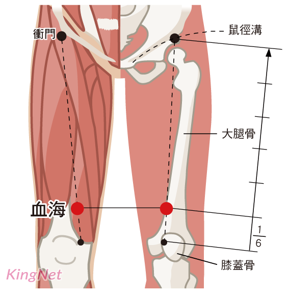 血海穴(百蟲窠)穴位 血海穴(百蟲窠)穴位