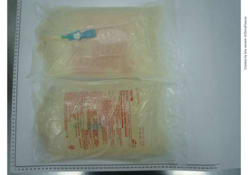 DIANEAL LOW CALCIUM (2.5MEQ/L) PERITONEAL DIALYSIS SOLUTION WITH 4.25" DEXTROSE "百特"含4.25％葡萄糖低鈣（2.5 mEq/L）腹膜透析液