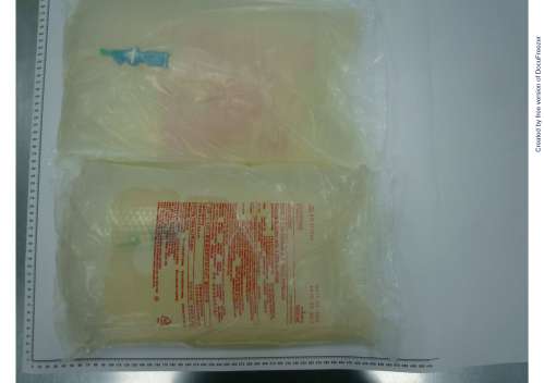 DIANEAL LOW CALCIUM (2.5MEQ/L) PERITONEAL DIALYSIS SOLUTION WITH 4.25" DEXTROSE "百特"含4.25％葡萄糖低鈣（2.5 mEq/L）腹膜透析液(3)