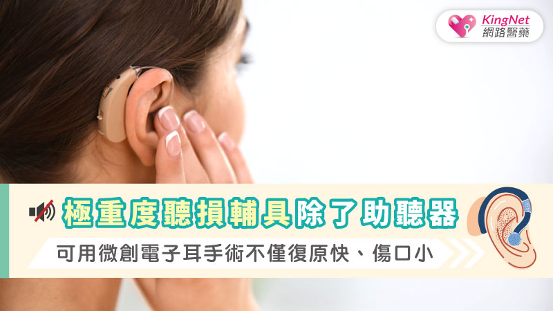  極重度聽損輔具除了助聽器，可用微創電子耳手術不僅復原快、傷口小_圖1