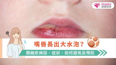 嘴唇長出大水泡？唇皰疹病因、症狀、如何避免及預防