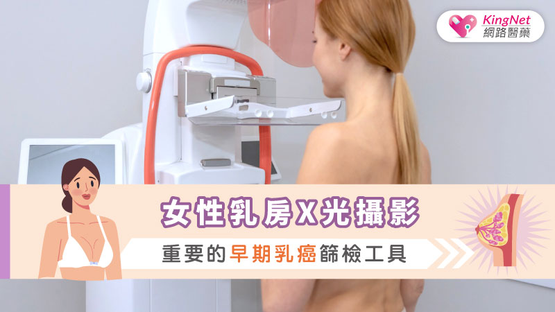 女性乳房X光攝影：重要的早期乳癌篩檢工具_圖1