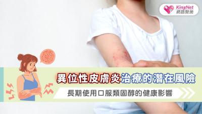 異位性皮膚炎治療的潛在風險：長期使用口服類固醇的健康影響