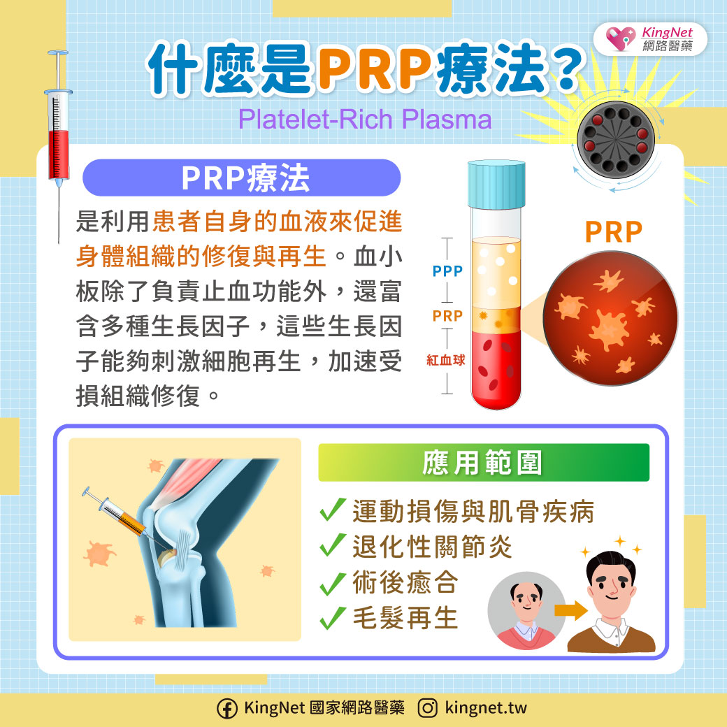 什麼是PRP療法？